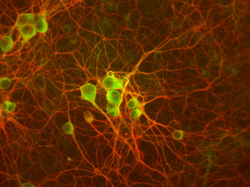 Rat Cerebellum Neurons