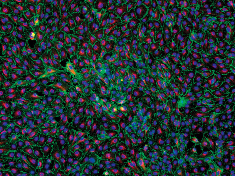 HMVEC-dLyAd-Der Lym Endo EGM-2MV,amp