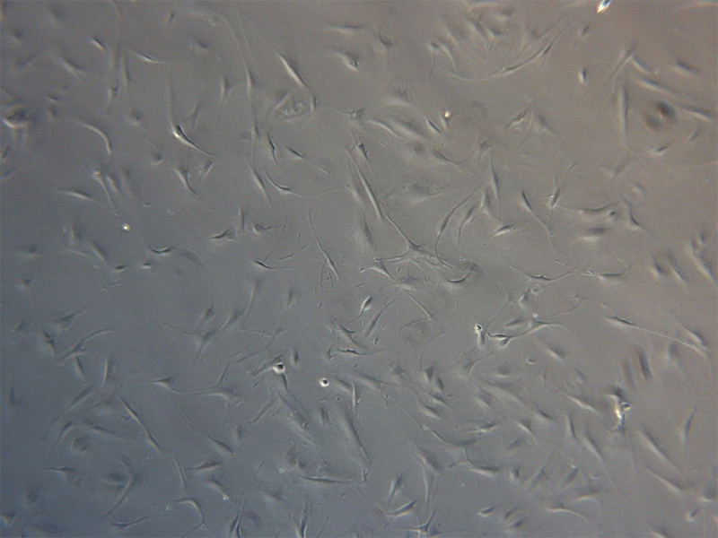 Cryo Human Stellates 1e5 per vial