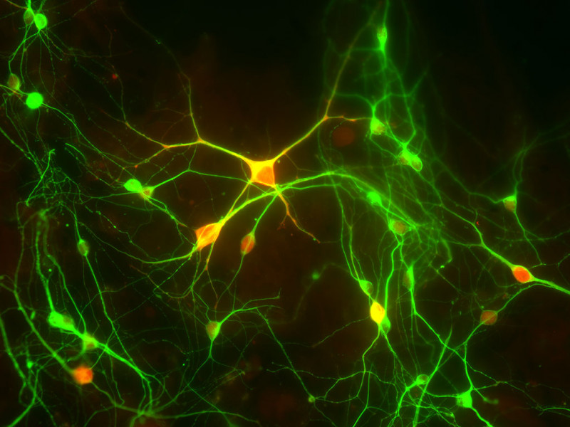 Rat Brain Striatum Neuron amp, 4M cells
