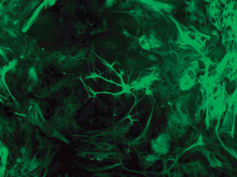 Rat Brain Striatum Astro amp, 1M cells