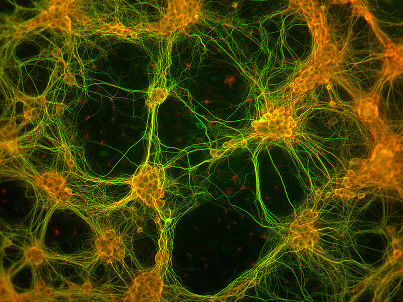 Rat Brain HC Neurons cyro amp, 1M cells